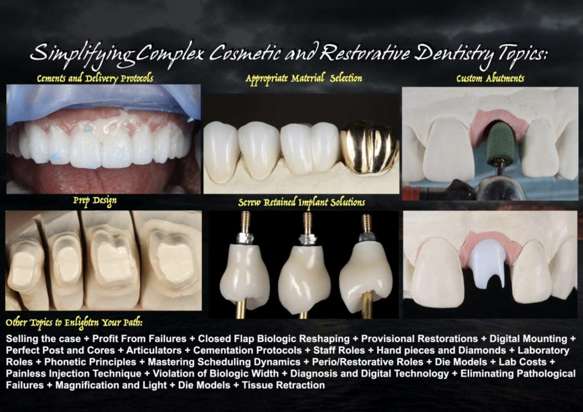 Cements and delivery protocols, appropriate material selection, custom abutments, prep design, screw-retained implant solutions