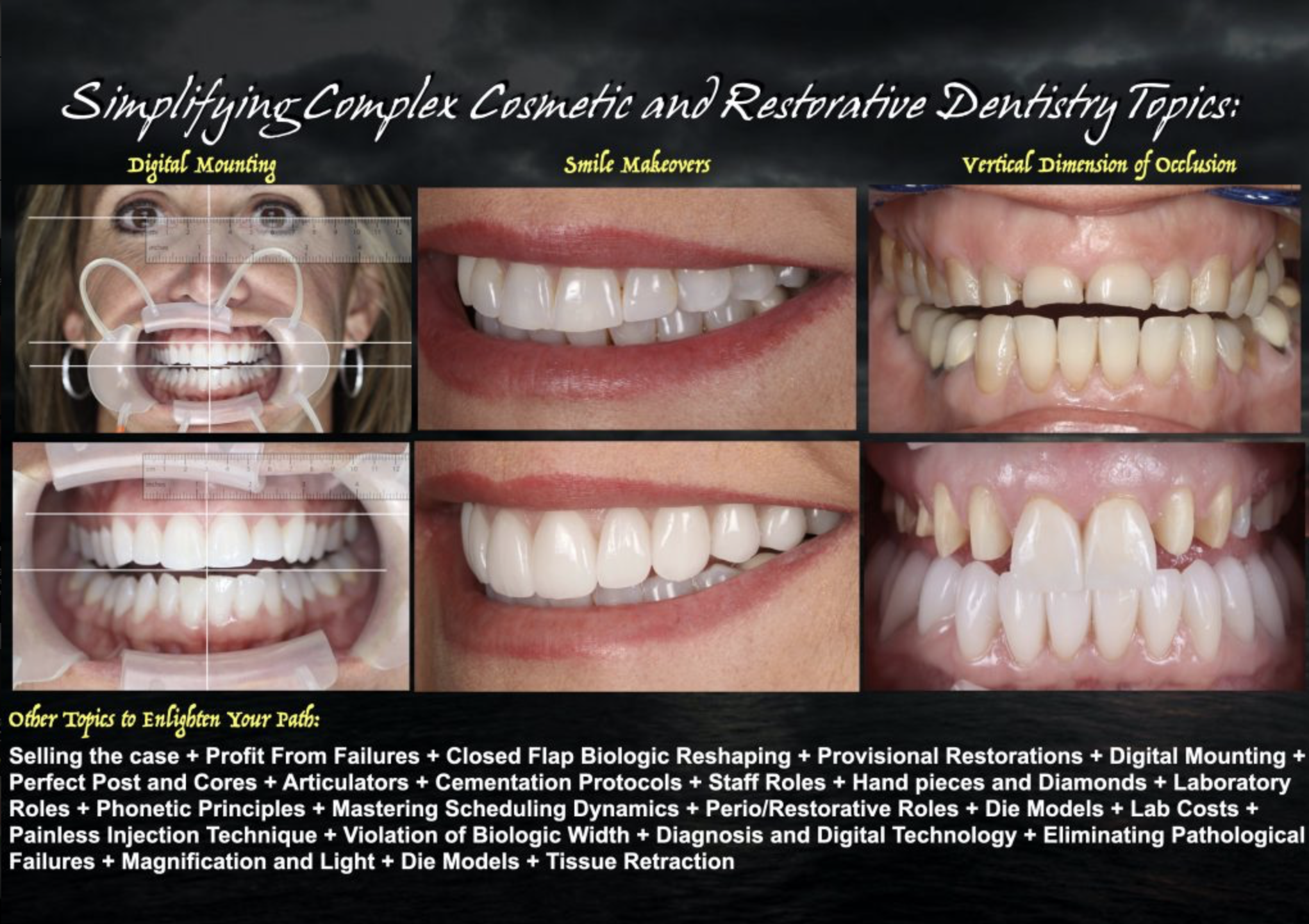 Digital mounting, smile makeovers, vertical dimension of occlusion — full curriculum topic list