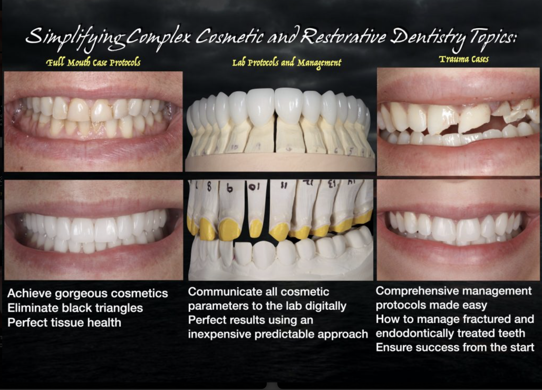 Full-mouth case protocols, lab protocols and management, trauma case management — before and after photographs