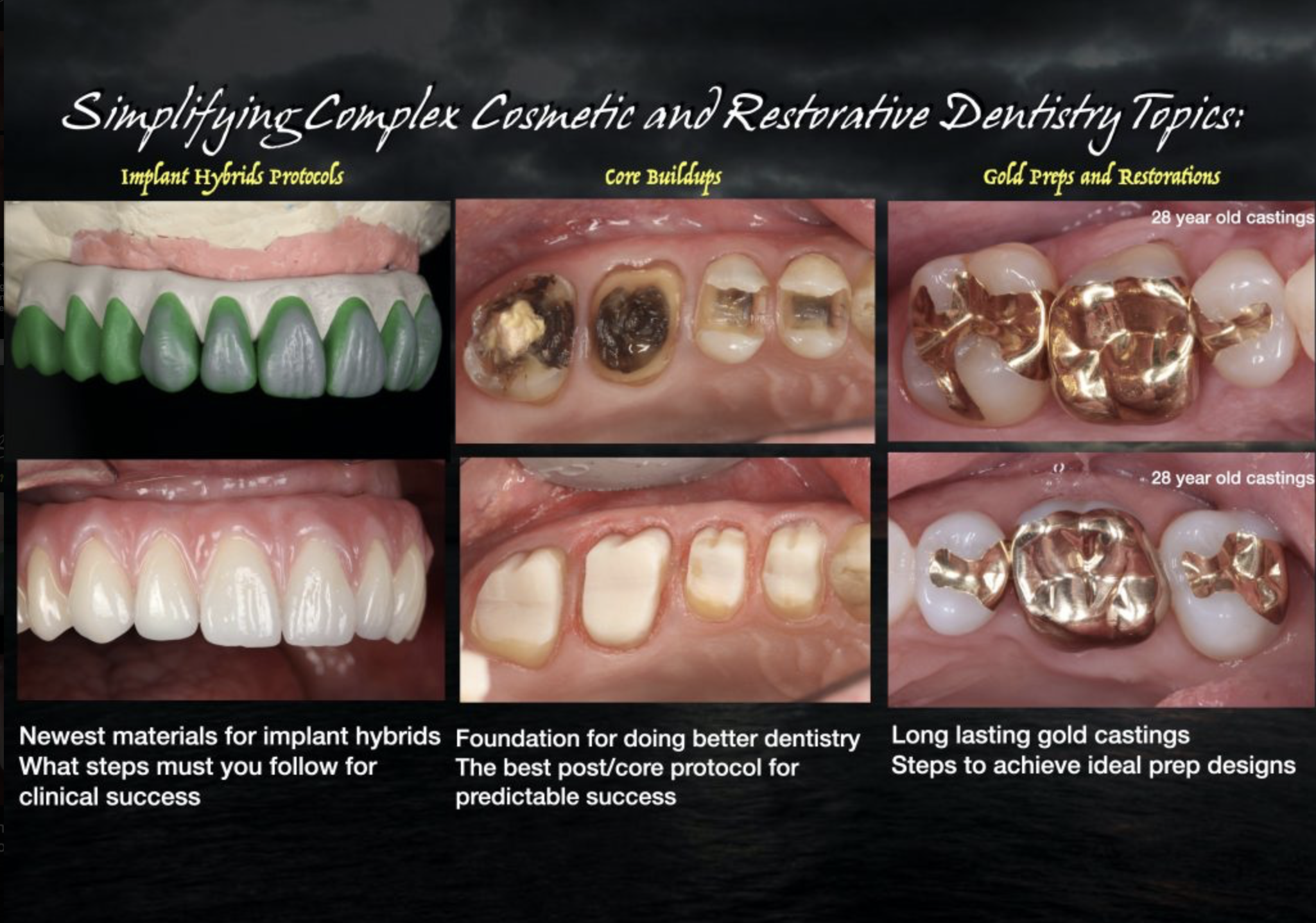 Implant hybrids, core buildups, and gold preps — clinical case grid with 28-year-old gold castings