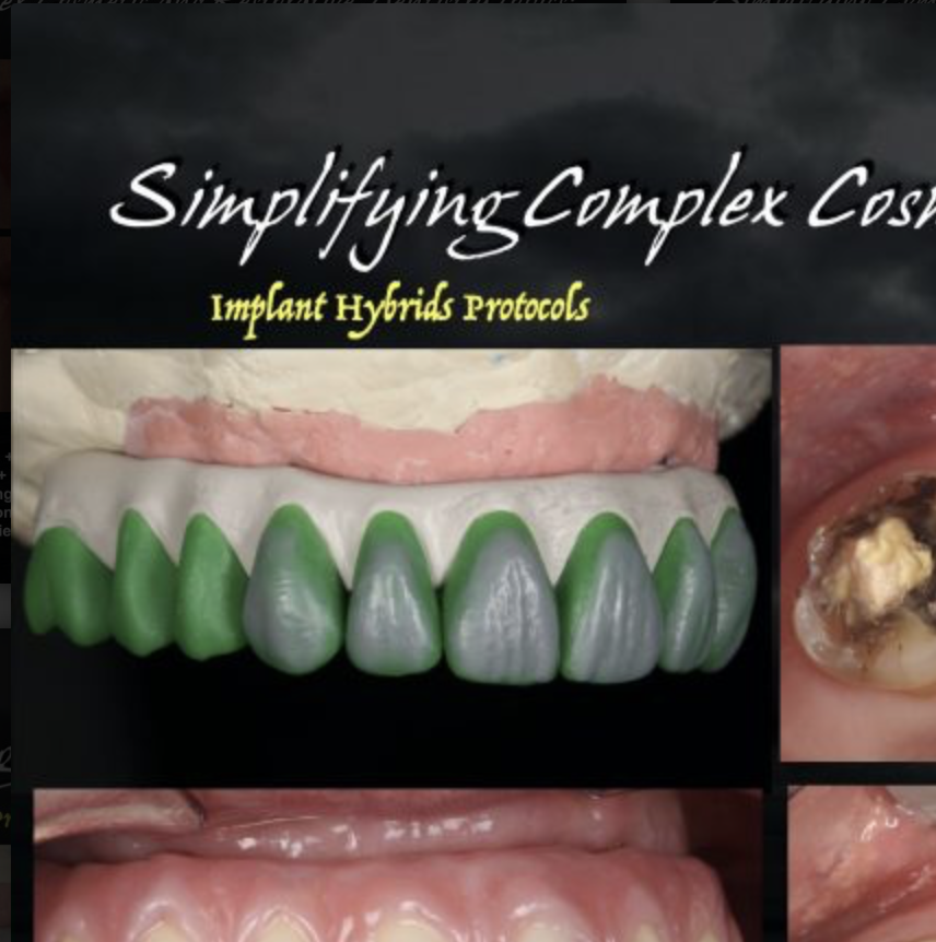 Implant hybrid protocols — newest materials, clinical-success steps, before and after photographs