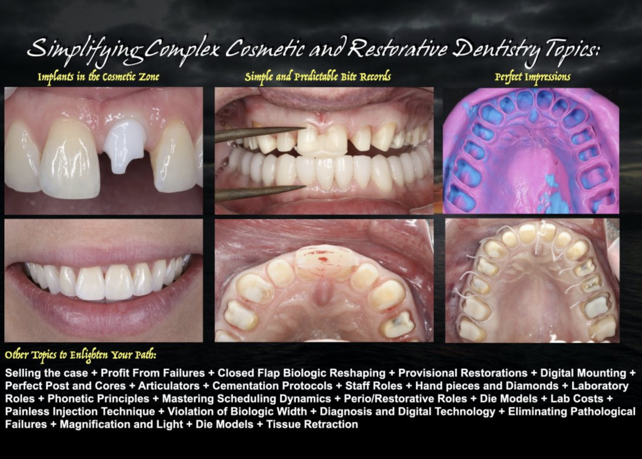 Implants in the cosmetic zone, simple and predictable bite records, perfect impressions — clinical case grid